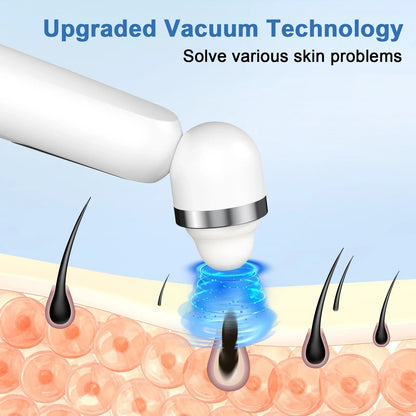 NEXPURE Blackhead Remover Vacuum, Blackhead Extractor with Camera, Pore Cleanser for Men and Women, Skin Care Tool with 5 Probes